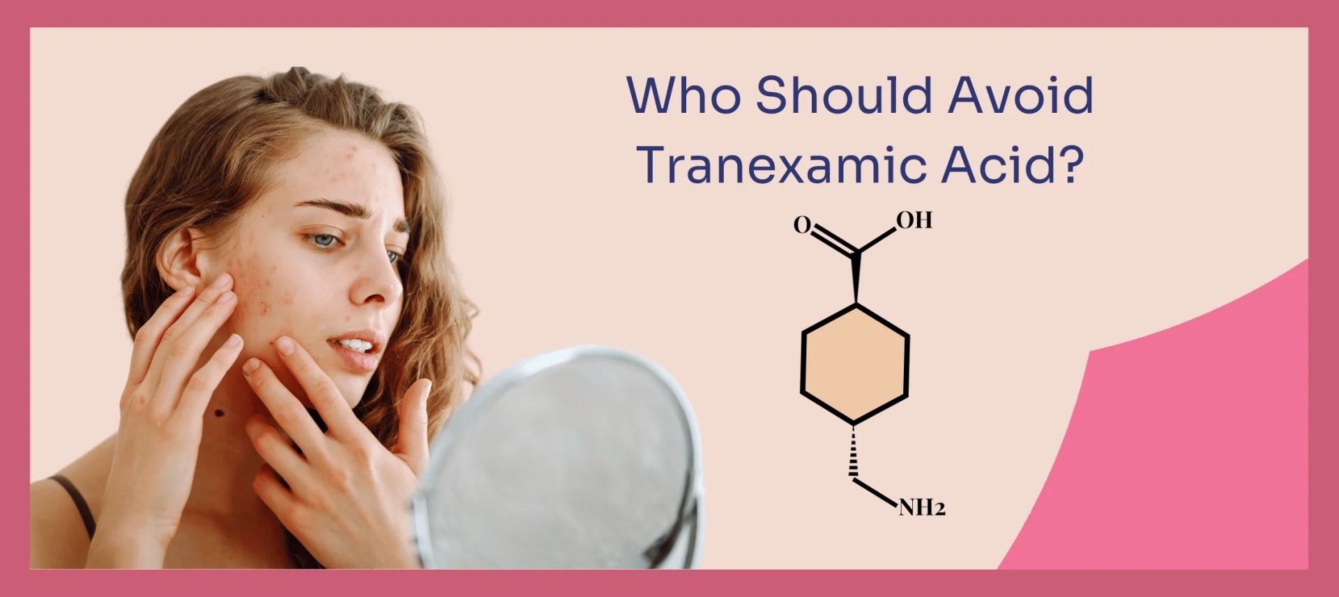 网红“氨甲环酸”被批准用于色斑治疗了吗？